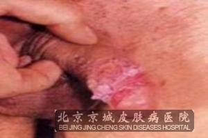 ��ֳ�������;��