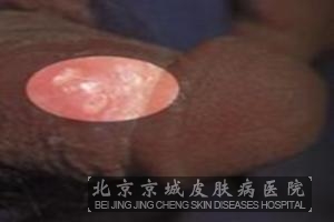 ��ֳ������ķ���ԭ����ʲô