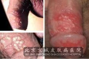 ��ֳ���������ԭ����ʲô