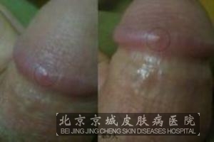 ��ֳ������Ĵ�����ʽ�м���