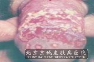 Ǳ���ڵ���ֳ������ᴫȾ��