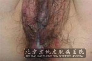 Ů����ֳ��������ʲôΣ��