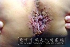 ��������ֳ������ʲôʱ����Ϻ�