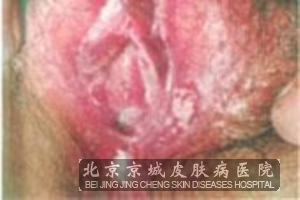 Ϊʲô��ֳ���������׸���