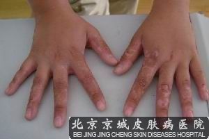 糣ĲЩ