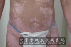 绤