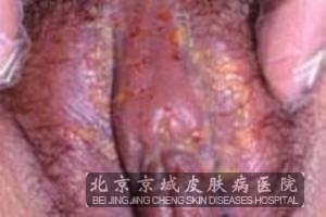 Ů����ֳ������Ҫ��ô��