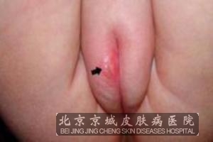 ��ֳ�����������ЩΣ����