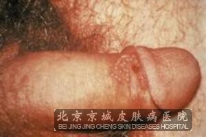 ��ֳ���������Ʋ���ʱ����ô��