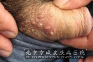 ��ֳ�������֢״����