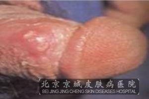 ��ֳ�����������Ƶ�ԭ������Щ