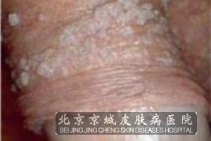 ��ֳ������Ӧ����λ�����