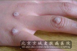 ��Ⱦ������ϺõĻ���������ʲô