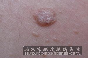 ��ƽ���ٴ����� ��