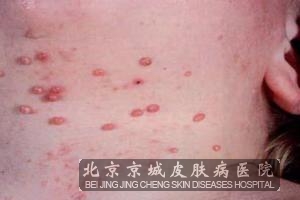 ��ƽ��Ƥ������ע������