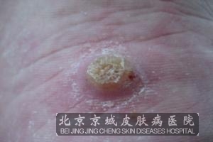 ��ƽ��ı���Ԥ����������Щ