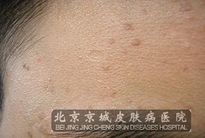 ��ƽ��Ĵ�����ʽ����Щ