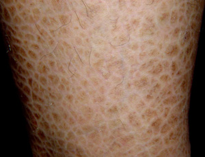 ���۲��Ƿ�Ⱦ