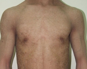 ���۲����ڶ���ʲô֢״