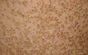 ���۲��������Լ��ص�ԭ����ʲô