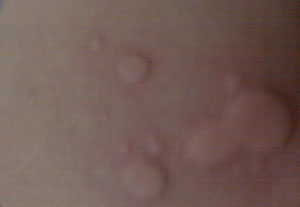 ����ݡ����ᴫȾ��