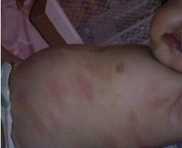 ��ͯݡ��������Ʒ�����ʲô