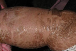 ���۲�����Ƥ�������ԭ������Щ