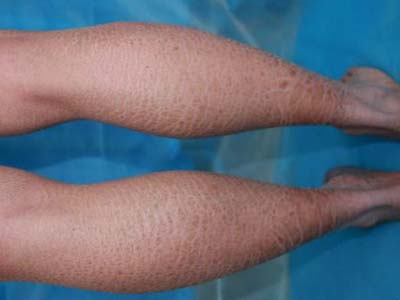 �������۲���ҩ