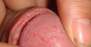 ��Ƥ����ʲôҩЧ���Ϻ�