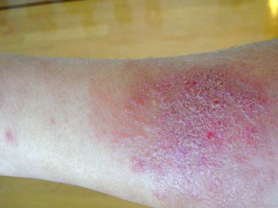 Ƥ����ô����