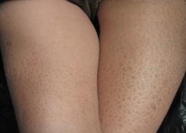۲ 