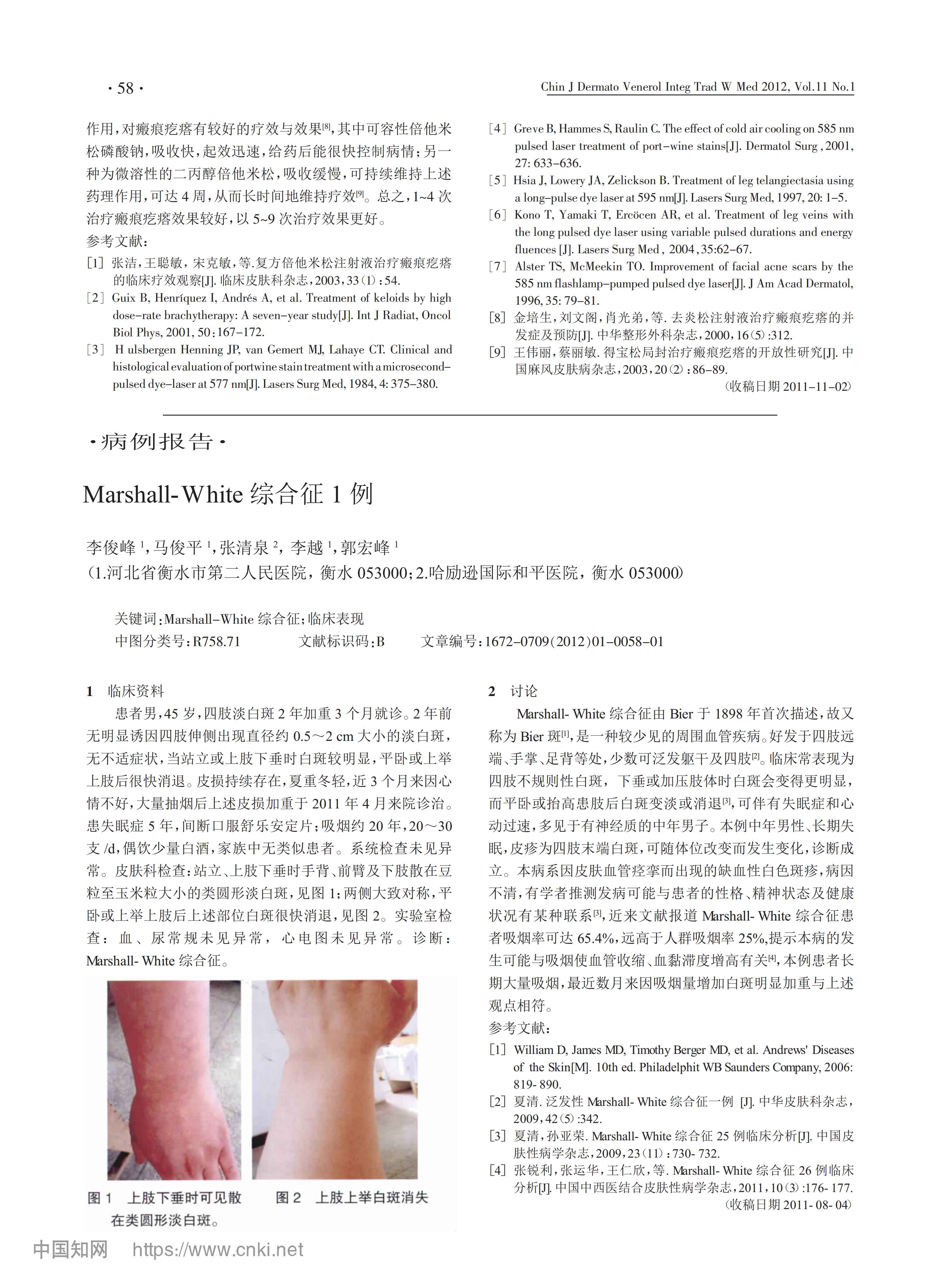 Cynergy激光联合复方倍他米松注射液治疗瘢痕疙瘩临床观察
