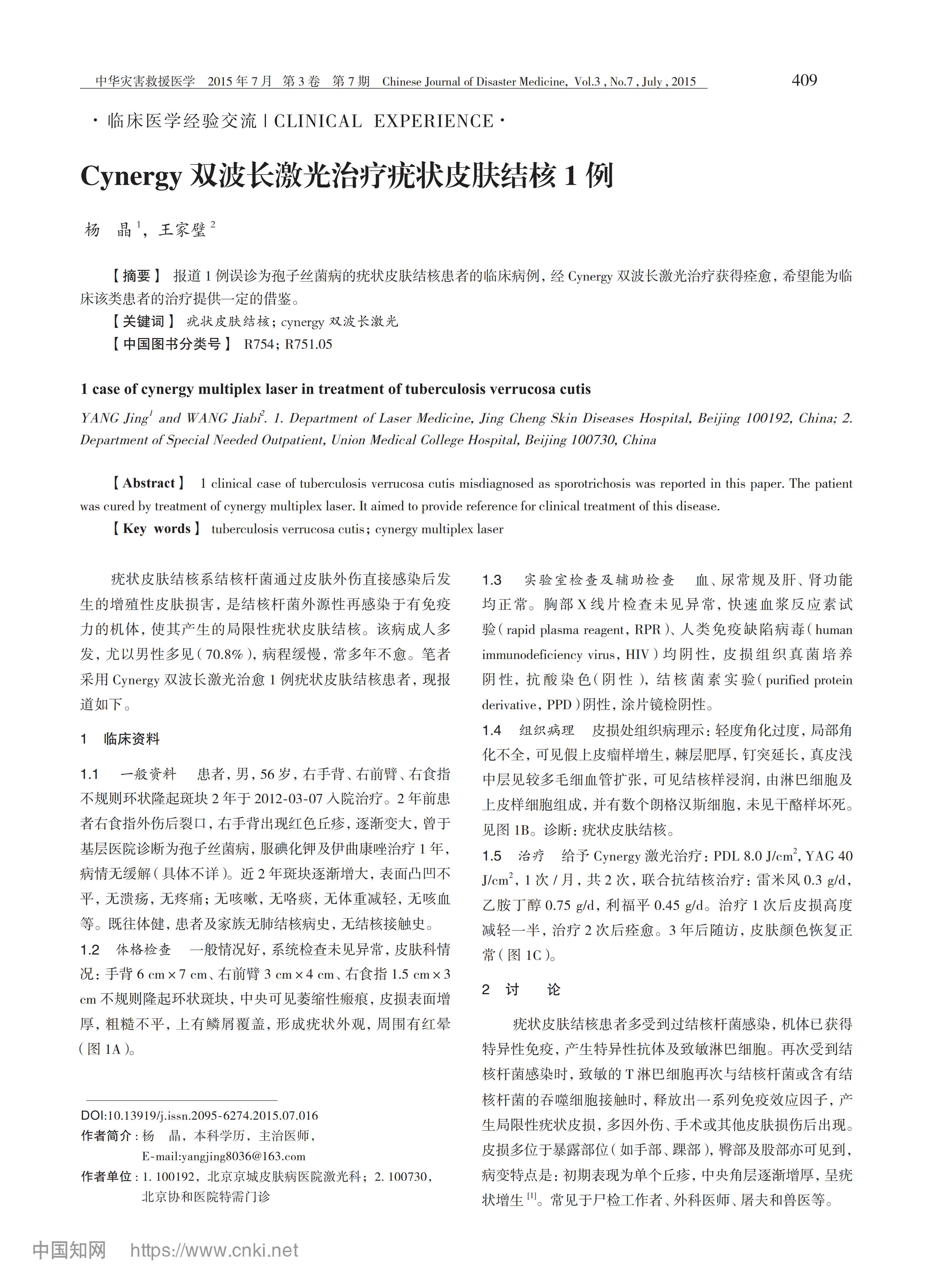 Cynergy双波长激光治疗疣状皮肤结核1例