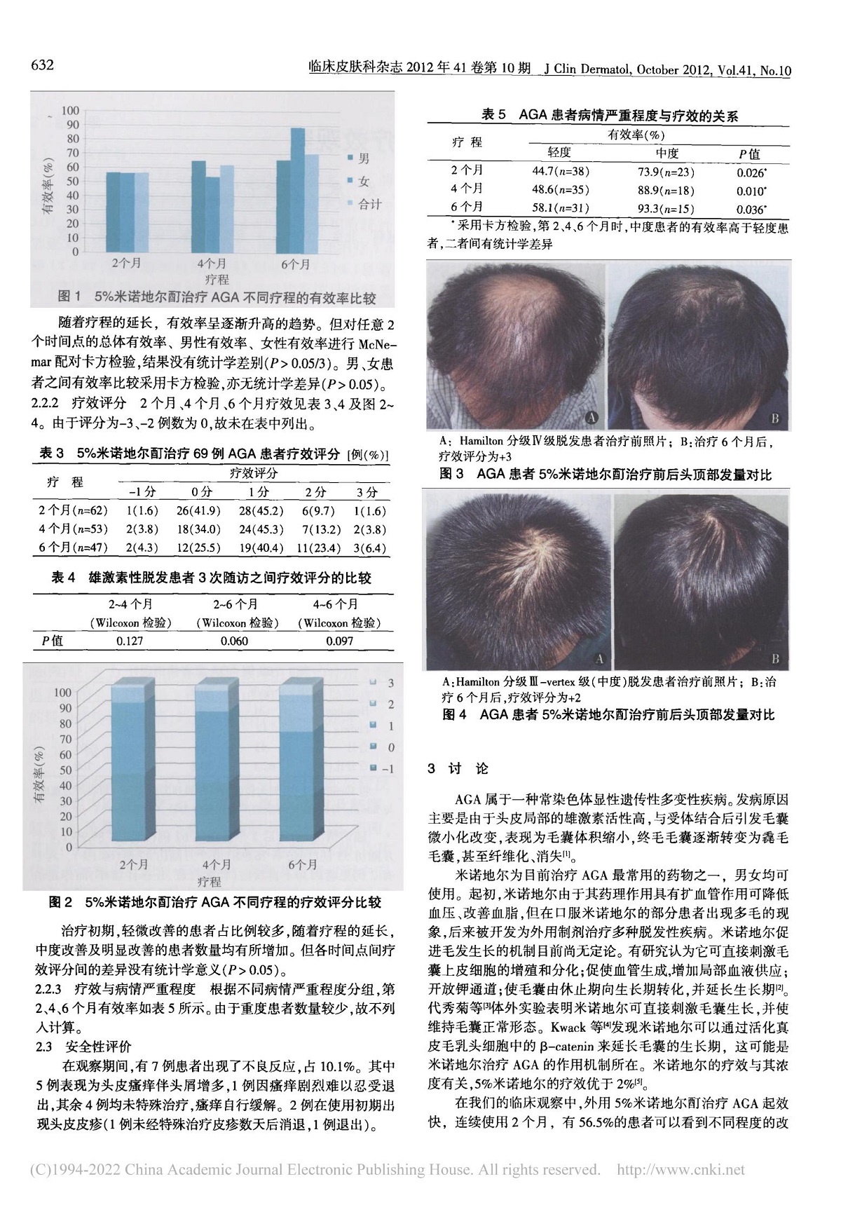 5%米诺地尔酊治疗雄激素性脱发疗效观察