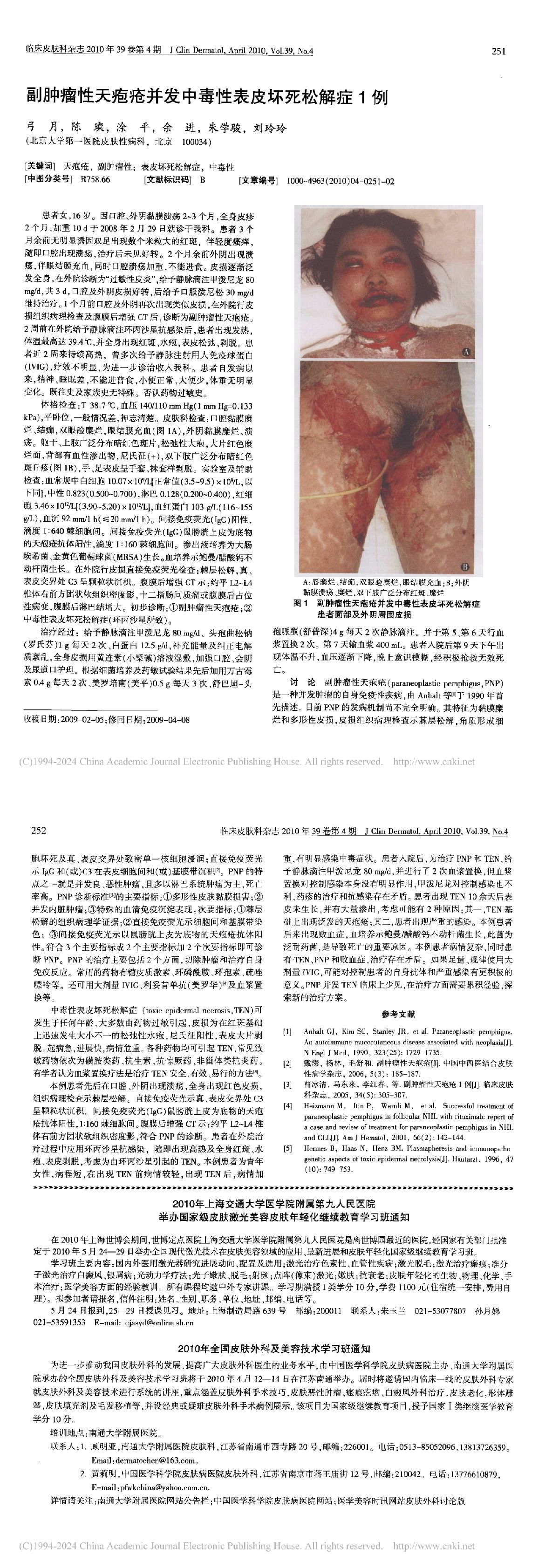 副肿瘤性天疱疮并发中毒性表皮坏死松解症1例