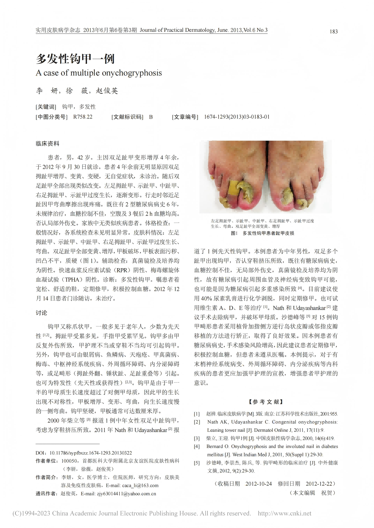 多发性钩甲一例
