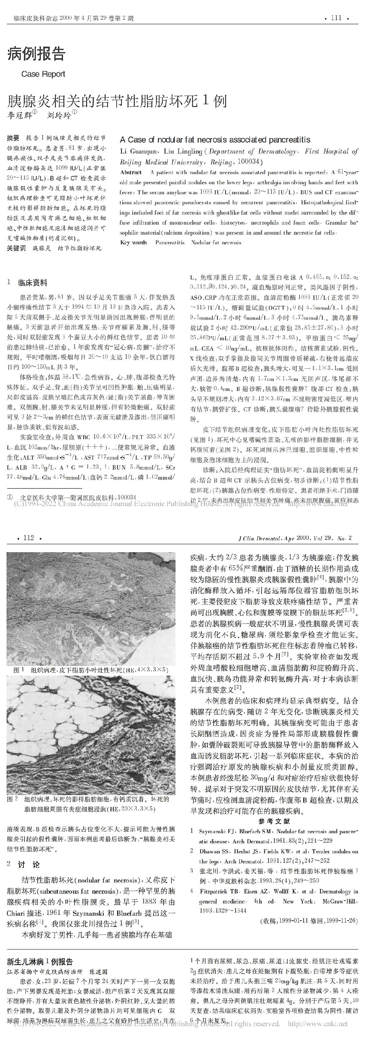 胰腺炎相关的结节性脂肪坏死1例