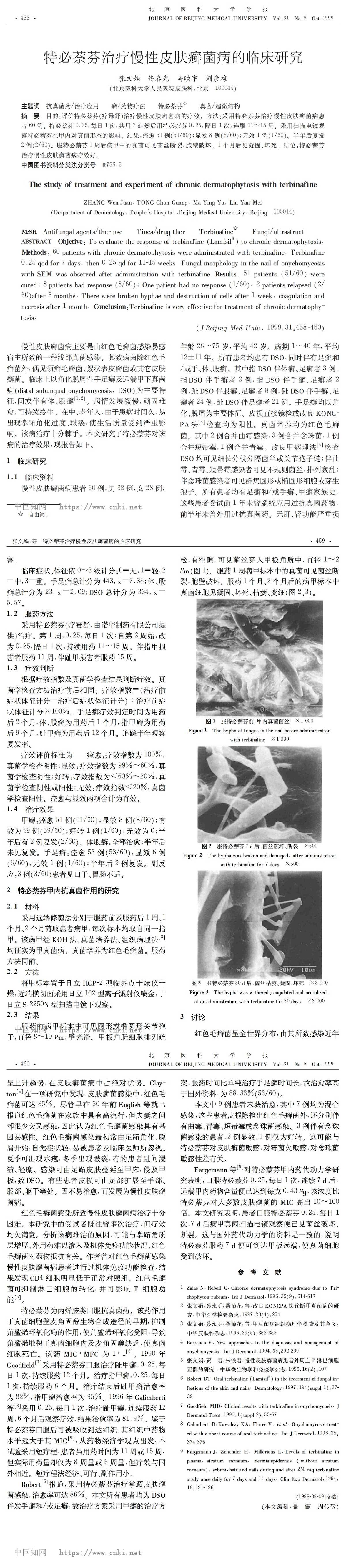 特必萘芬治疗慢性皮肤癣菌病的临床研究