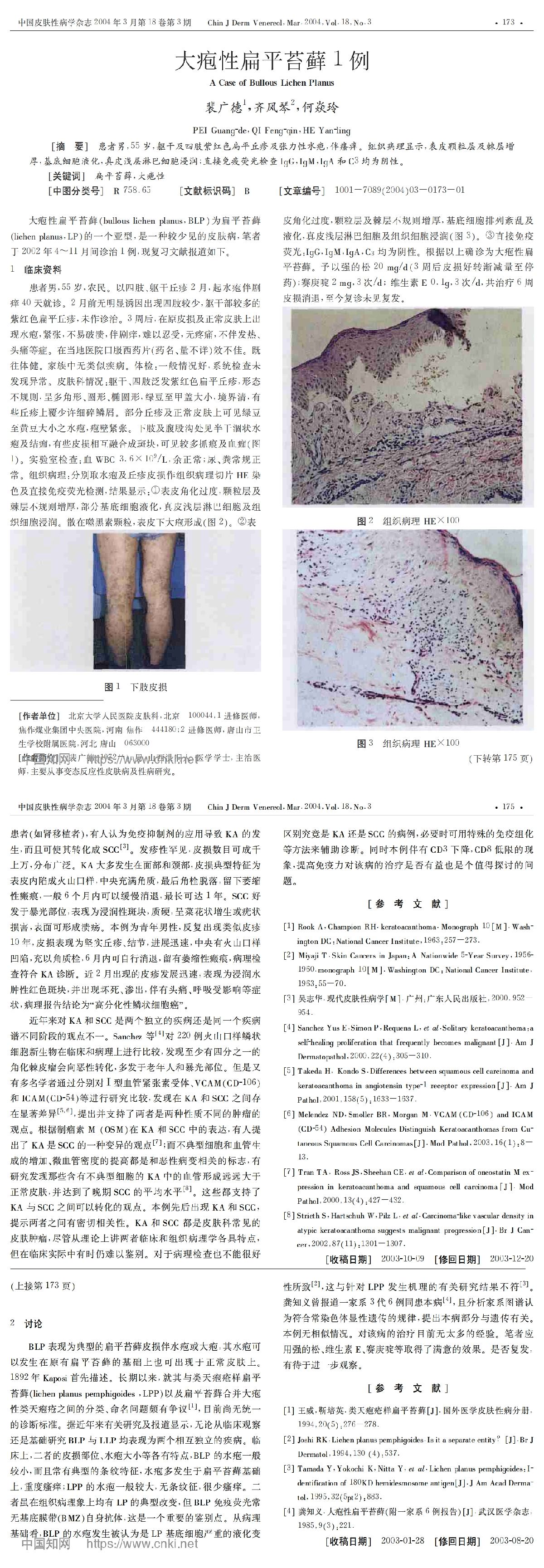 大疱性扁平苔藓1例