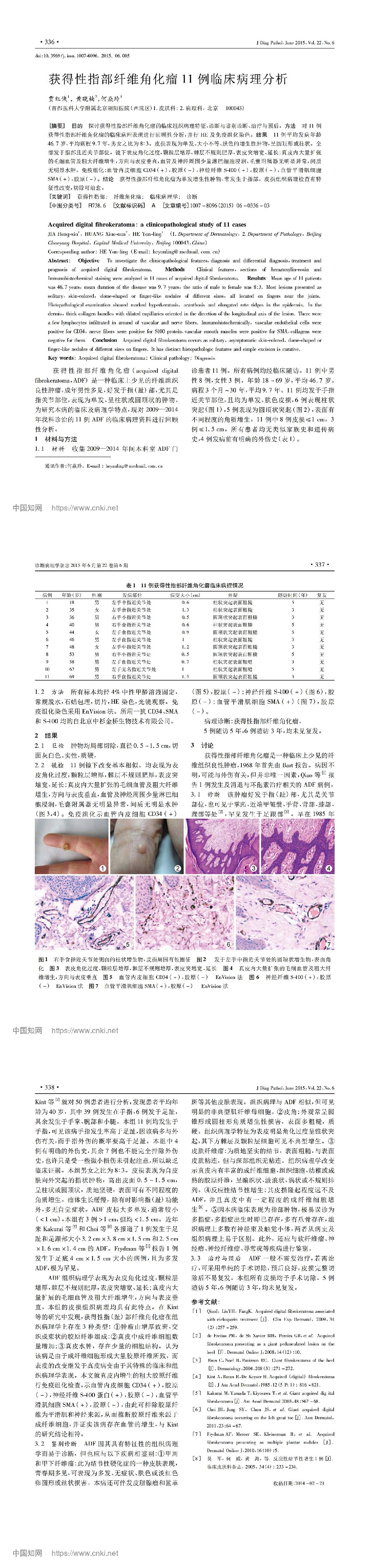 获得性指部纤维角化瘤 11 例临床病理分析