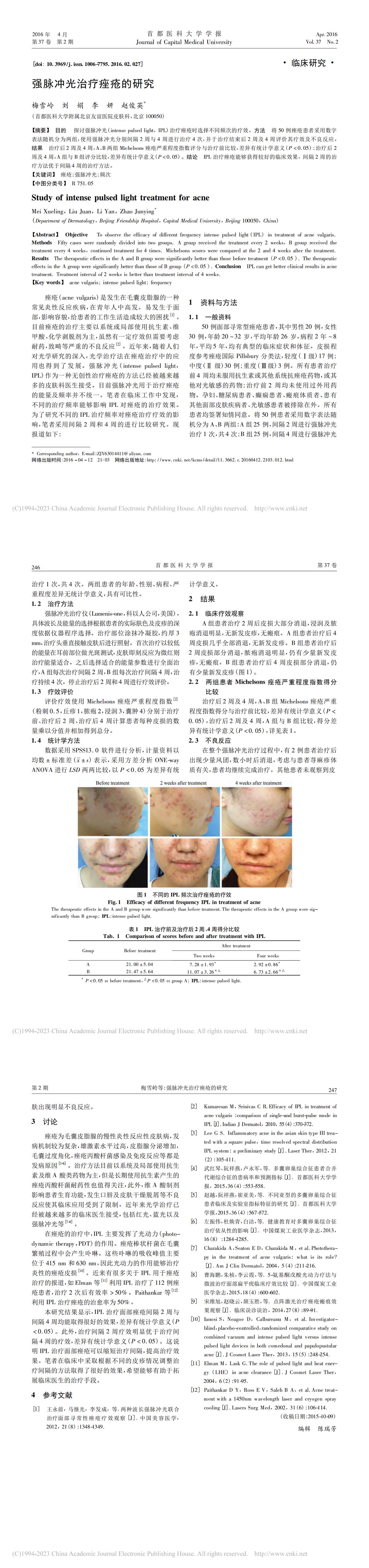 强脉冲光治疗痤疮的研究
