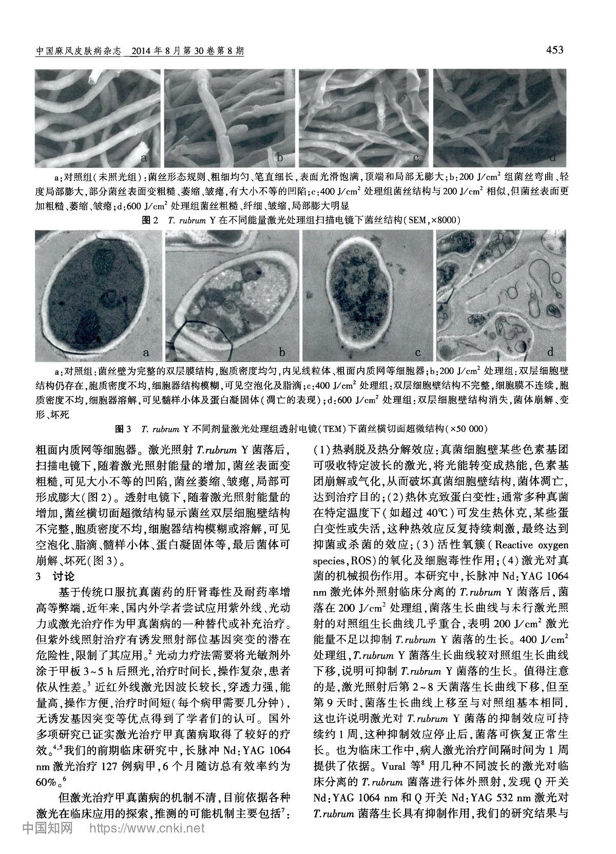 长脉冲Nd:YAG1064nm激光对红色毛癣菌生长及超微结构的影响