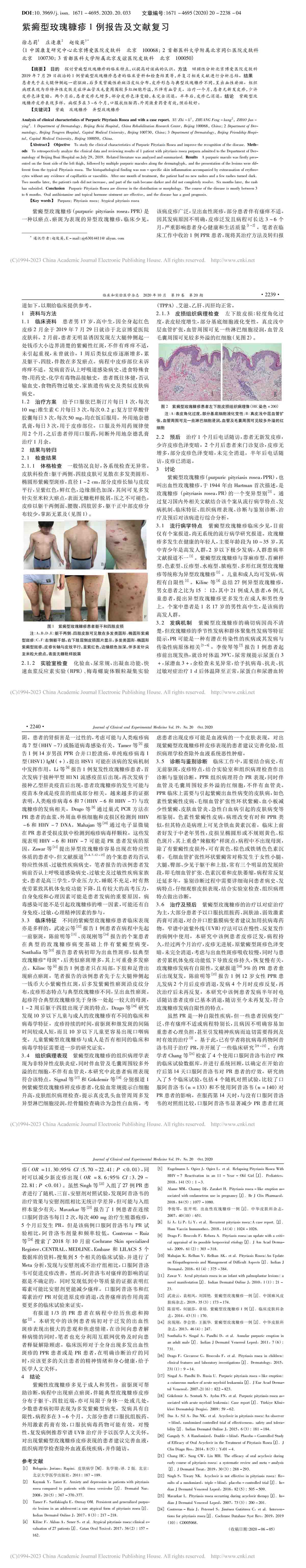 紫癜型玫瑰糠疹1例报告及文献复习