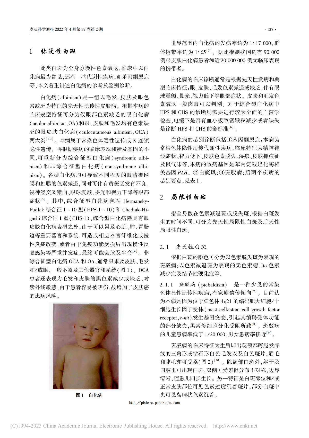 儿童色素减退性皮肤病的诊断