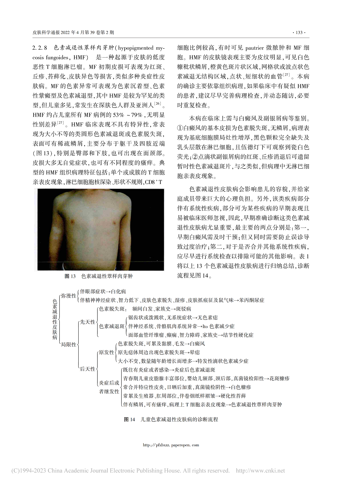 儿童色素减退性皮肤病的诊断
