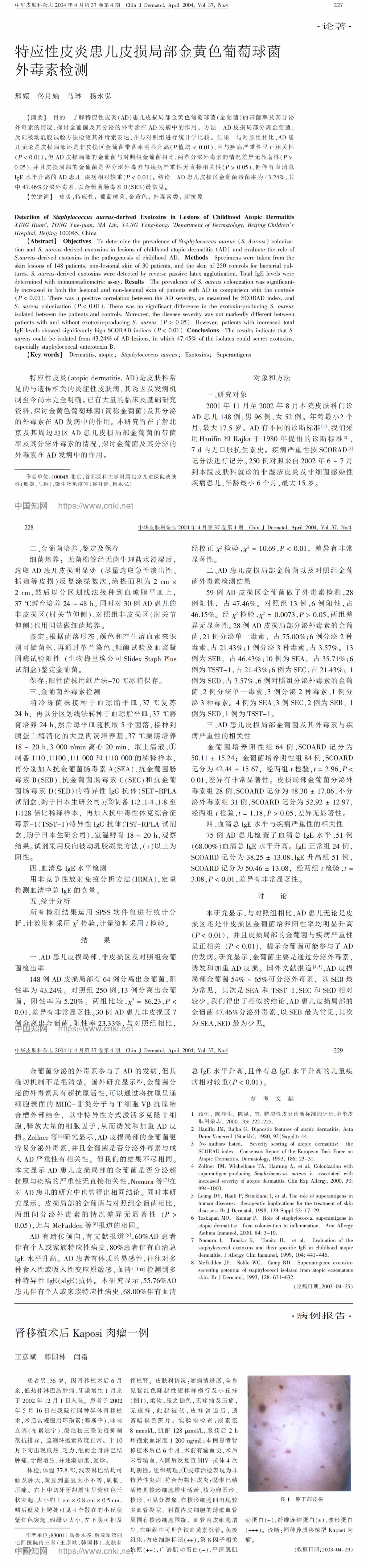 特应性皮炎患儿皮损局部金黄色葡萄球菌外毒素检测