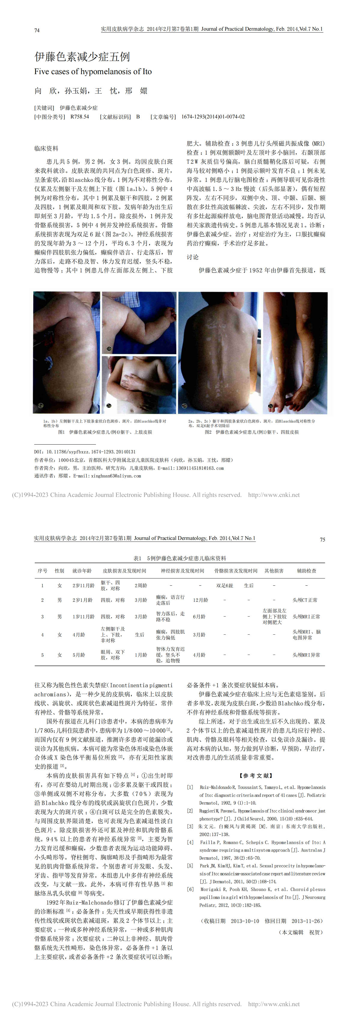 伊藤色素减少症五例