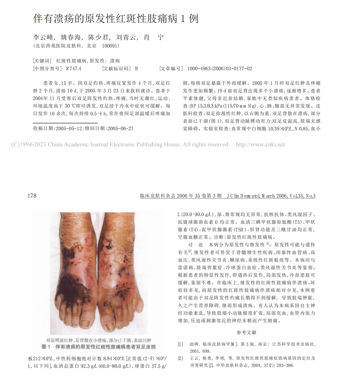 伴有溃疡的原发性红斑性肢痛病 1 例