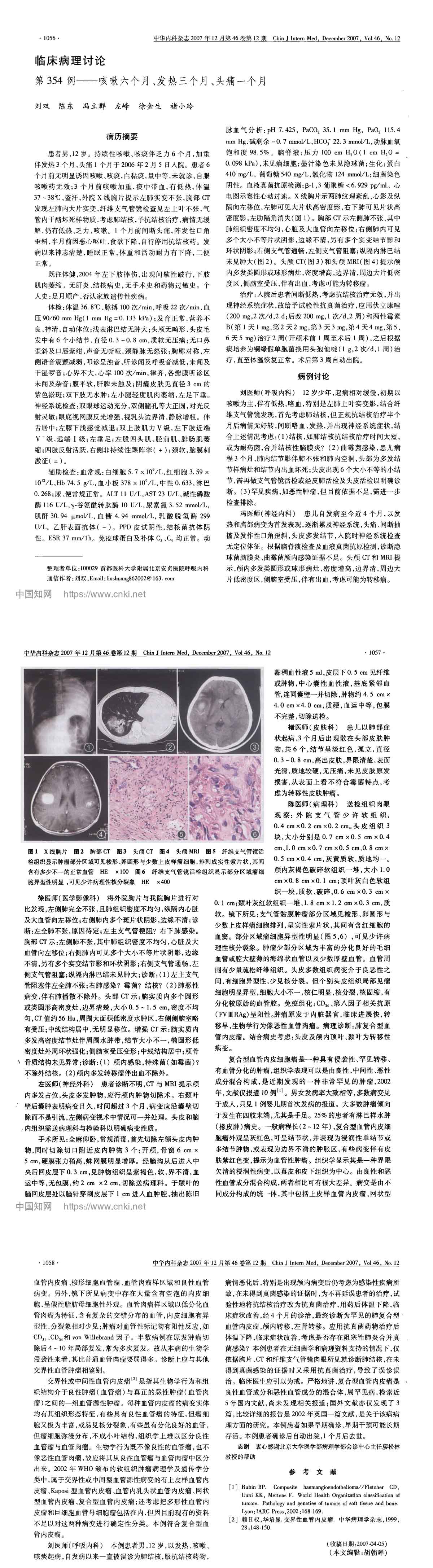第354例--咳嗽六个月、发热三个月、头痛一个月