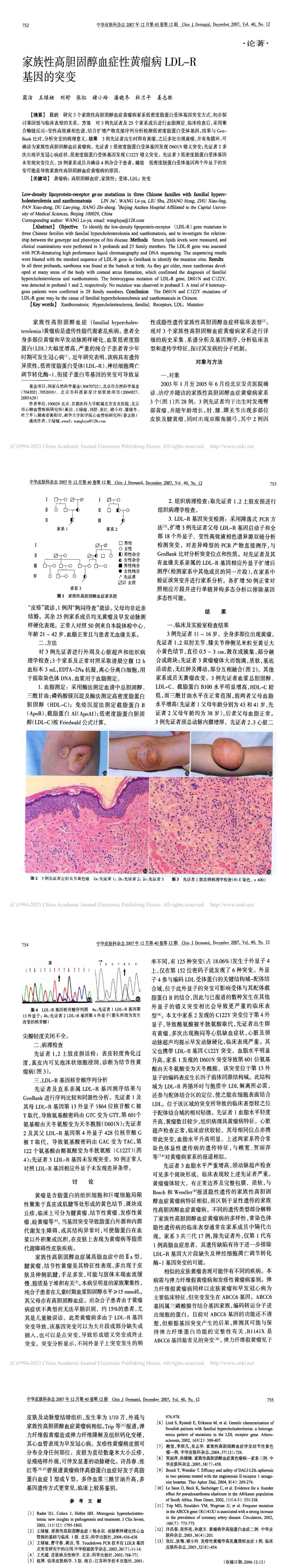 家族性高胆固醇血症性黄瘤病LDL-R基因的突变